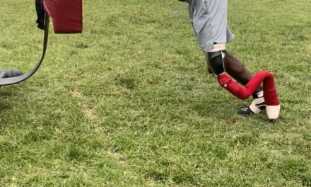 Shreveport Shriners patient with prosthetic leg plays varsity football in Mississippi